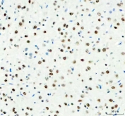 IHC staining of FFPE rat brain tissue with DDX1 antibody. HIER: boil tissue sections in pH8 EDTA for 20 min and allow to cool before testing.