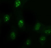 Immunofluorescent staining of FFPE human HeLa cells with DDX1 antibody. HIER: boil tissue sections in pH6 citrate buffer for 20 min and allow to cool before testing.