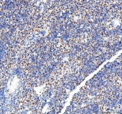 IHC staining of FFPE human spleen tissue with DDX1 antibody. HIER: boil tissue sections in pH8 EDTA for 20 min and allow to cool before testing.