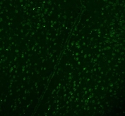 Immunofluorescent staining of FFPE mouse brain tissue with DDX1 antibody. HIER: boil tissue sections in pH8 EDTA for 20 min and allow to cool before testing.