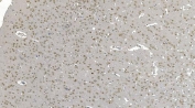 IHC staining of FFPE rat brain with DDX1 antibody. HIER: boil tissue sections in pH8 EDTA for 20 min and allow to cool before testing.