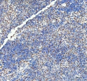 IHC staining of FFPE human spleen tissue with DDX1 antibody. HIER: boil tissue sections in pH8 EDTA for 20 min and allow to cool before testing.