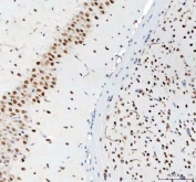 IHC staining of FFPE mouse brain tissue with DDX1 antibody. HIER: boil tissue sections in pH8 EDTA for 20 min and allow to cool before testing.