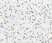 IHC staining of FFPE rat brain tissue with DDX1 antibody. HIER: boil tissue sections in pH8 EDTA for 20 min and allow to cool before testing.