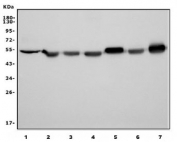 Western blot testing of human 1) HeLa, 2) Jurkat, 3) HEK293, 4) K562, 5) rat brain, 6) rat C6 and 7) mouse brain lysate with TUBA1 antibody. Predicted molecular weight ~50 kDa.