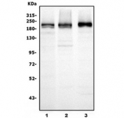 Western blot testing of human 1) HEK293, 2) Jurkat and 3) K562 cell lysate with UBR2 antibody. Predicted molecular weight ~202 kDa.