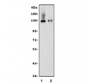 Western blot testing of 1) rat PC-12 and 2) mouse liver lysate with ABCB1 antibody. Expected molecular weight: 141-180 kDa depending on glycosylation level.