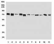 Western blot testing of human 1) HeLa, 2) HepG2, 3) U-2 OS, 4) SW620, 5) ThP-1, 6) Raji, 7) SGC-7901, 8) rat liver, 9) rat testis, 10) mouse liver and 11) mouse testis lysate with ADAMTS5 antibody. Predicted molecular weight ~102 kDa, but the processed forms can be observed at approx. 50-102 kDa.
