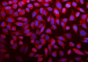 Immunofluorescent staining of FFPE human HeLa cells with Argonaute 3 antibody (red) and DAPI nuclear stain (blue). HIER: steam section in pH6 citrate buffer for 20 min.