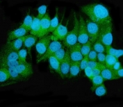 Immunofluorescent staining of FFPE human MCF7 cells with MEK2 antibody (green) and DAPI nuclear stain (blue). HIER: steam section in pH6 citrate buffer for 20 min.