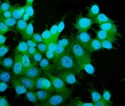 Immunofluorescent staining of FFPE human MCF7 cells with MAP2K2 antibody (green) and DAPI nuclear stain (blue). HIER: steam section in pH6 citrate buffer for 20 min.
