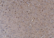 IHC staining of FFPE mouse brain with TORC1/CRTC1 antibody. HIER: boil tissue sections in pH8 EDTA for 20 min and allow to cool before testing.