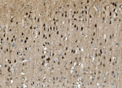 IHC staining of FFPE rat brain with TORC1/CRTC1 antibody. HIER: boil tissue sections in pH8 EDTA for 20 min and allow to cool before testing.
