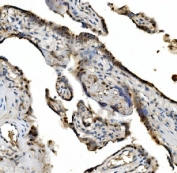 IHC staining of FFPE human placental tissue with VPRBP antibody. HIER: boil tissue sections in pH8 EDTA for 20 min and allow to cool before testing.