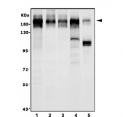 Western blot testing of 1) human HEK293, 2) human HepG2, 3) human K562, 4) rat testis and 5) mouse testis lysate with VPRBP antibody. Predicted molecular weight ~180 kDa.
