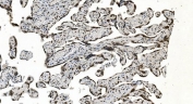 IHC staining of FFPE human placental tissue with hnRNP H3 antibody. HIER: boil tissue sections in pH8 EDTA for 20 min and allow to cool before testing.