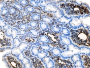 IHC staining of FFPE mouse intestine tissue with Icam1 antibody. HIER: boil tissue sections in pH8 EDTA for 20 min and allow to cool before testing.
