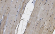 IHC staining of FFPE human skeletal muscle with MEK5 antibody. HIER: boil tissue sections in pH8 EDTA for 20 min and allow to cool before testing.