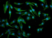 Immunofluorescent staining of FFPE mouse RM-1 cells with Irf3 antibody (green) and DAPI nuclear stain (blue). HIER: steam section in pH6 citrate buffer for 20 min.