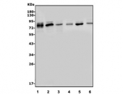 Western blot testing of 1) human A431, 2) human HEK293, 3) human U-2 OS, 4) rat RH-35, 5) mouse liver and 6) mouse testis lysate with MT2-MMP antibody. Predicted molecular weight ~74 kDa.