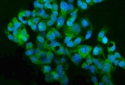 Immunofluorescent staining of FFPE human HepG2 cells with MT2-MMP antibody (green) and DAPI nuclear stain (blue). HIER: steam section in pH6 citrate buffer for 20 min.