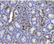 IHC staining of FFPE mouse intestinal tissue with Cd20 antibody. HIER: boil tissue sections in pH8 EDTA for 20 min and allow to cool before testing.