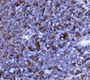 IHC staining of FFPE mouse spleen tissue with Cd20 antibody. HIER: boil tissue sections in pH8 EDTA for 20 min and allow to cool before testing.