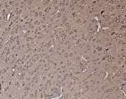 IHC staining of FFPE rat brain with PFN2 antibody. HIER: boil tissue sections in pH8 EDTA for 20 min and allow to cool before testing.