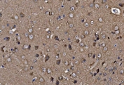 IHC staining of FFPE mouse brain with PFN2 antibody. HIER: boil tissue sections in pH8 EDTA for 20 min and allow to cool before testing.