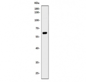 Western blot testing of human U-2 OS cell lysate with PHF21B antibody. Predicted molecular weight ~57 kDa.