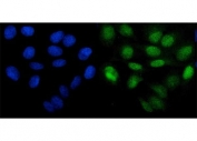 Immunofluorescent staining of FFPE human U-2 OS cells with PHF21B antibody (green) and DAPI nuclear stain (blue). HIER: steam section in pH6 citrate buffer for 20 min.