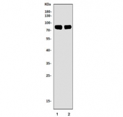 Western blot testing of 1) rat brain and 2) mouse brain tissue lysate with cPLA2-beta antibody. Predicted molecular weight ~88 kDa.