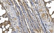 IHC staining of FFPE rat lung tissue with PRKG1 antibody. HIER: boil tissue sections in pH8 EDTA for 20 min and allow to cool before testing.