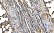 IHC staining of FFPE rat lung tissue with PRKG1 antibody. HIER: boil tissue sections in pH8 EDTA for 20 min and allow to cool before testing.