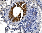 IHC staining of FFPE mouse lung tissue with PRKG1 antibody. HIER: boil tissue sections in pH8 EDTA for 20 min and allow to cool before testing.