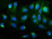 Immunofluorescent staining of FFPE human U-2 OS cells with PRKG1 antibody (green) and DAPI nuclear stain (blue). HIER: steam section in pH6 citrate buffer for 20 min.