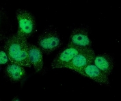 Immunofluorescent staining of FFPE human A431 cells with Poliovirus Receptor antibody (green) and DAPI nuclear stain (blue). HIER: steam section in pH6 citrate buffer for 20 min.