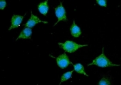 Immunofluorescent staining of FFPE mouse HEPA1-6 cells with Slc10a1 antibody (green) and DAPI nuclear stain (blue). HIER: steam section in pH6 citrate buffer for 20 min.