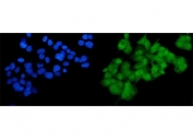 Immunofluorescent staining of FFPE human HepG2 cells with SOX18 antibody (green) and DAPI nuclear stain (blue). HIER: steam section in pH6 citrate buffer for 20 min.