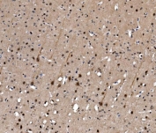 IHC staining of FFPE rat brain with Serum Response Factor antibody. HIER: boil tissue sections in pH8 EDTA for 20 min and allow to cool before testing.