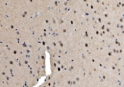 IHC staining of FFPE mouse brain with Serum Response Factor antibody. HIER: boil tissue sections in pH8 EDTA for 20 min and allow to cool before testing.