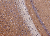 IHC staining of FFPE mouse brain tissue with Synaptic vesicle glycoprotein 2A antibody. HIER: boil tissue sections in pH8 EDTA for 20 min and allow to cool before testing.