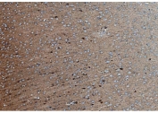 IHC staining of FFPE rat brain tissue with Synaptic vesicle glycoprotein 2A antibody. HIER: boil tissue sections in pH8 EDTA for 20 min and allow to cool before testing.