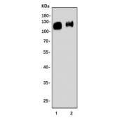 Western blot testing of 1) rat brain and 2) mouse brain lysate with Synaptic vesicle glycoprotein 2A antibody. Predicted molecular weight ~83 kDa but may be observed at larger sizes due to glycosylation. 