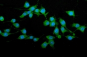 Immunofluorescent staining of FFPE mouse forestomach carcinoma cells (MFC) with Trim25 antibody (green) and DAPI nuclear stain (blue). HIER: steam section in pH6 citrate buffer for 20 min.