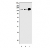 Western blot testing of 1) human placenta, 2) human T-47D and 3) monkey lung tissue lysate with Wolframin antibody. Predicted molecular weight ~100 kDa.