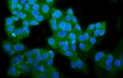 Immunofluorescent staining of FFPE human HepG2 cells with Wolframin antibody (green) and DAPI nuclear stain (blue). HIER: steam section in pH6 citrate buffer for 20 min.
