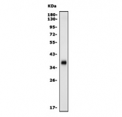 Western blot testing of mouse thymus with Programmed death ligand 1 antibody. Predicted molecular weight: 34-70 kDa depending on glycosylation level.