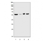 Western blot testing of 1) rat liver, 2) mouse liver, 3) rat C6 and 4) mouse HEPA1-6 cell lysate with CPN1 antibody. Predicted molecular weight ~52 kDa.