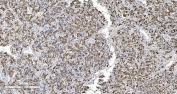 IHC staining of FFPE human adrenocortical adenoma tissue with ARG2 antibody. HIER: boil tissue sections in pH8 EDTA for 20 min and allow to cool before testing.